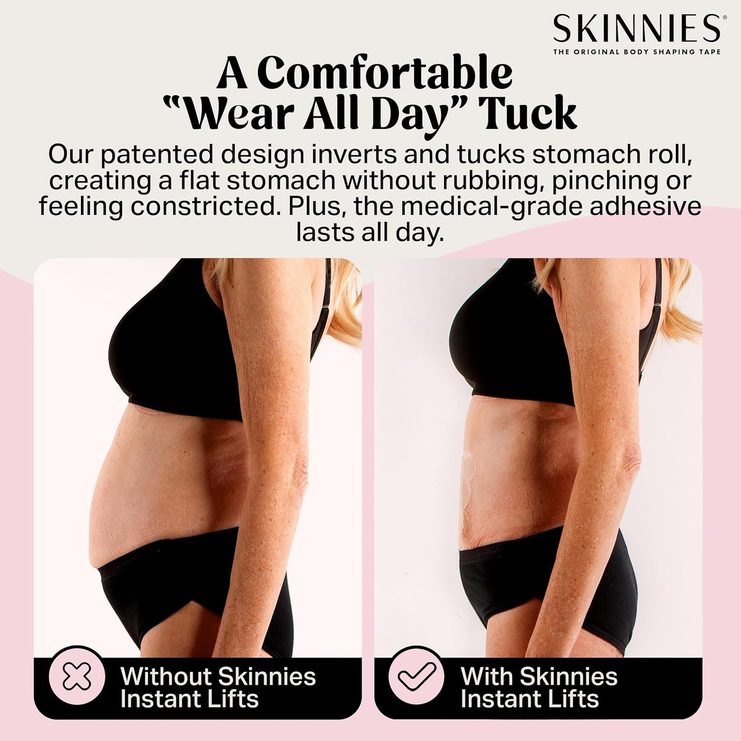Instant Lifts Tummy Tuck Tape (Pack of 5)
