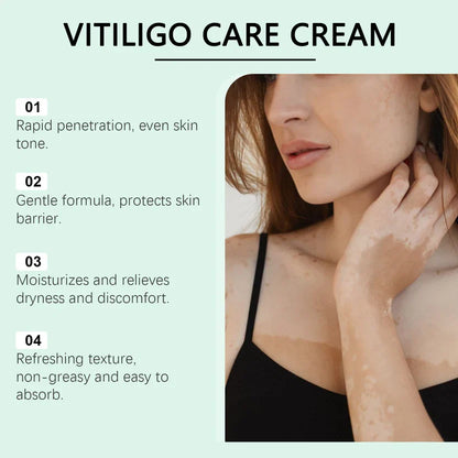 Vitiligo Care Cream