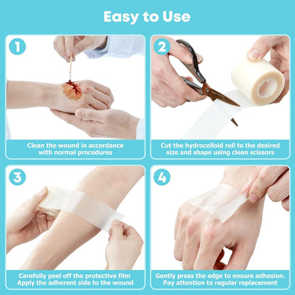 Hydrocolloid Roll for Wound Care