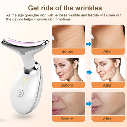EMS RED LIGHT THERAPY FACE NECK LIFT WRINKLE REMOVER TIGHTEN MASSAGER